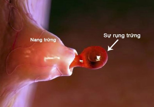 Trứng Đã Rụng Siêu Âm Có Thấy Không? Giải Mã Chu Trình Thụ Thai