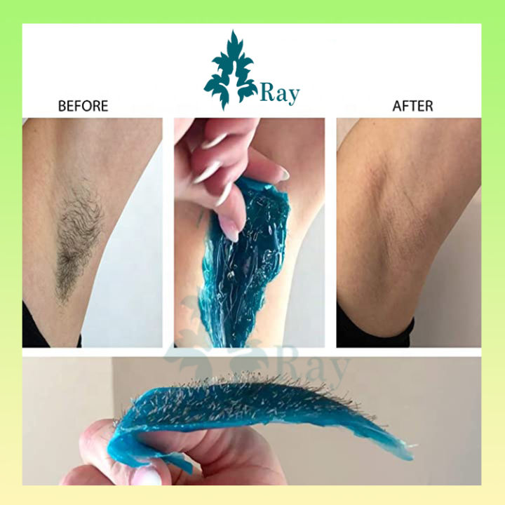 Wax Lông Vùng Kín: Cẩm Nang Toàn Diện Từ Chuyenseg Để Tự Tin Và Lành Mạnh