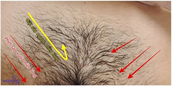 Wax Lông Vùng Kín: Cẩm Nang Toàn Diện Từ Chuyenseg Để Tự Tin Và Lành Mạnh