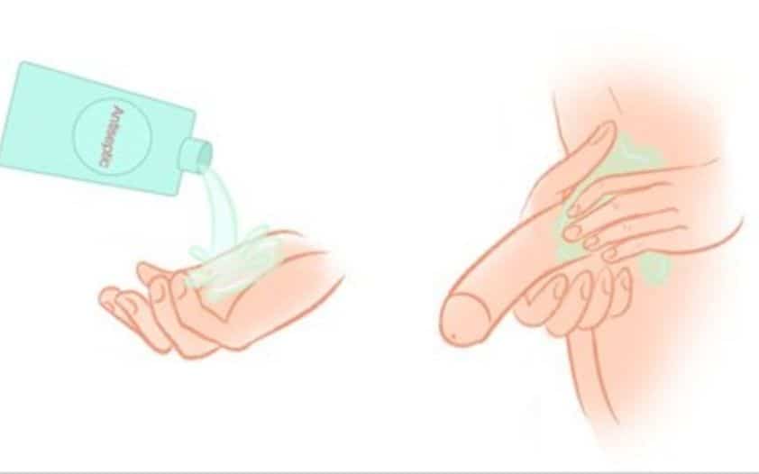 Vệ sinh cậu nhỏ bằng nước muối: Nên hay không và cách làm đúng?