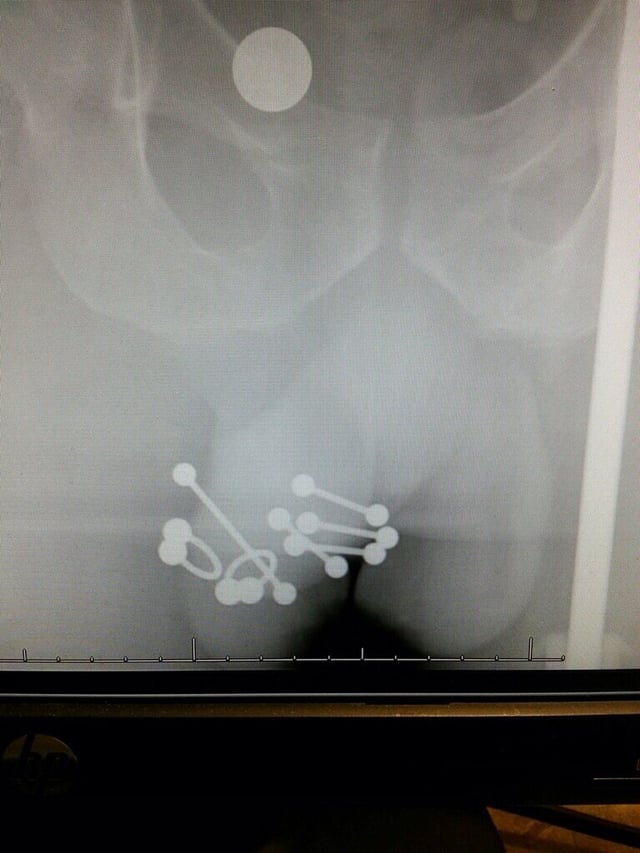 Xỏ Khuyên Dương Vật & Xỏ Khuyên Cậu Nhỏ: Khám Phá Thú Vị và An Toàn Của Bạn