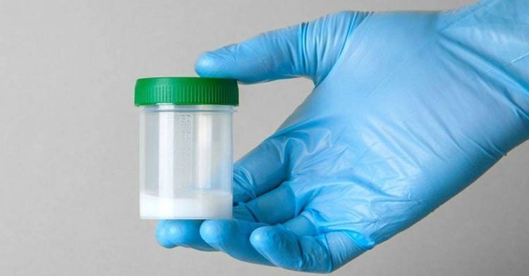 Giải Mã Tinh Trùng Có Chất Gì: Hiểu Rõ Về Cơ Thể Mình, Bạn Nhé!