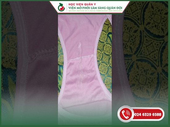 Tinh trùng dính vào quần áo bao lâu thì chết? Sự thật bạn cần biết