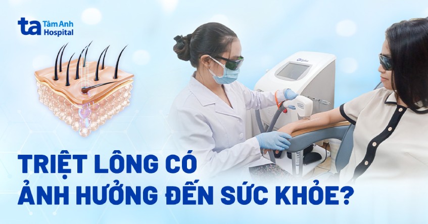 Triệt Lông Có Ảnh Hưởng Gì Không? Giải Đáp Từng Khía Cạnh Cùng Chuyenseg