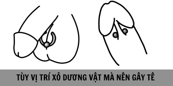 Xỏ Khuyên Dương Vật & Xỏ Khuyên Cậu Nhỏ: Khám Phá Thú Vị và An Toàn Của Bạn