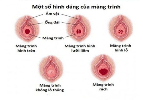 Trước Và Sau Khi Mất Trinh: Cùng Chuyện S.E.G. Gỡ Bỏ Những Băn Khoăn