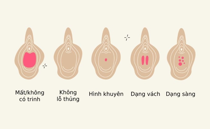 Trước Và Sau Khi Mất Trinh: Cùng Chuyện S.E.G. Gỡ Bỏ Những Băn Khoăn